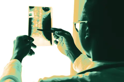 Doctor holding a spine X-ray up to the light